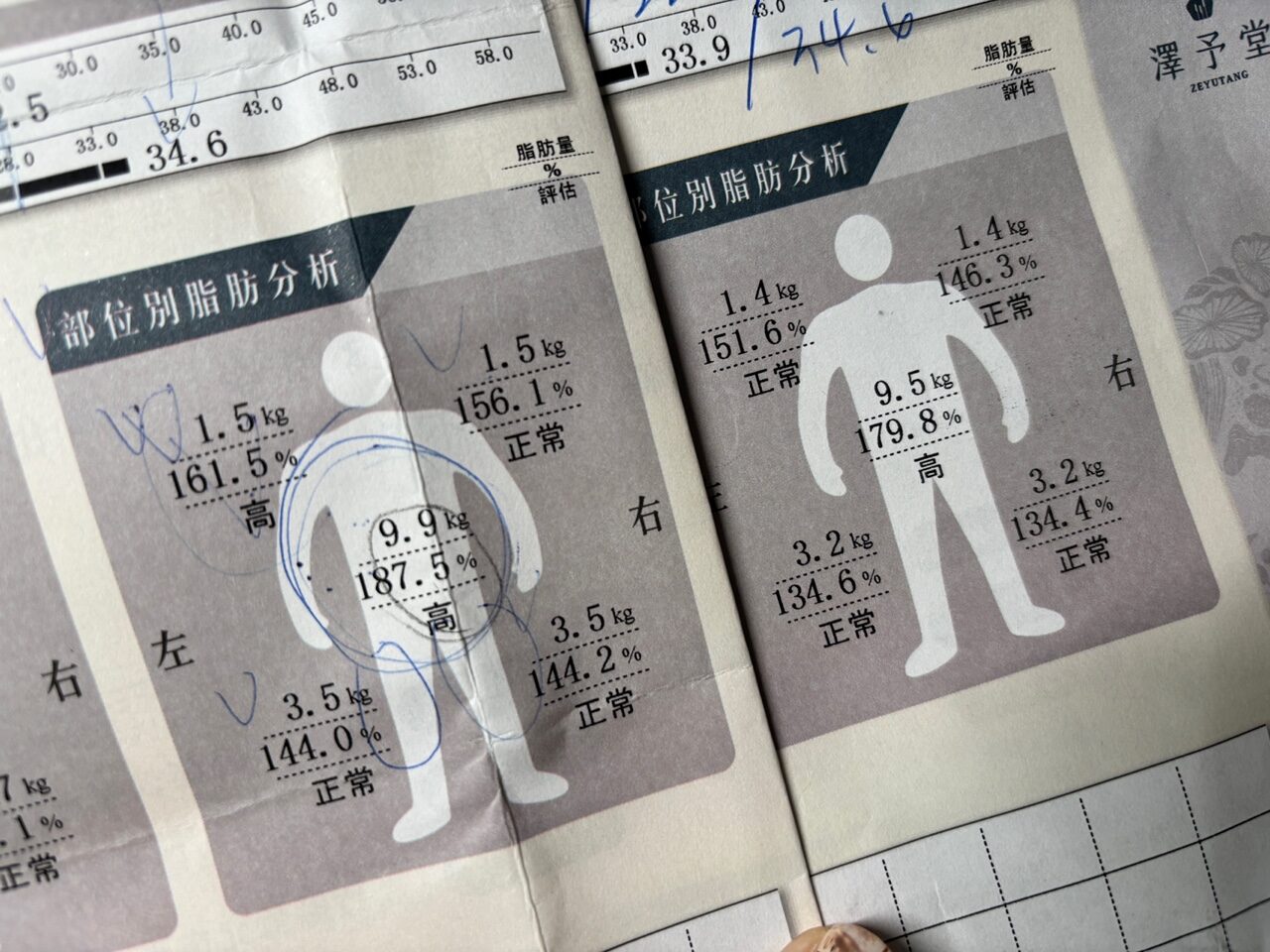 ▌健康話題|中醫+埋線有用嗎?我的「澤予堂竹北中醫診所」調理全心得分享 ▌ - 第16張圖