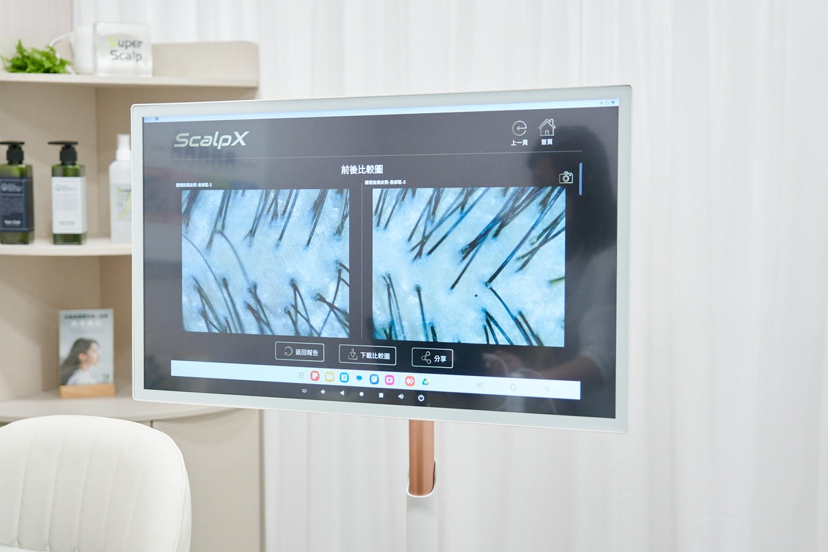 ▌生活提案|掉髮困擾怎麼辦?推薦「絲若雲建髮中心」AI頭皮檢測+日本SuperScalp授權、非侵入式活髮課程完整分享! ▌ - 第39張圖